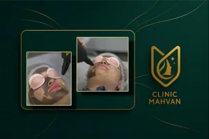 خدمات زیبایی و کربن تراپی در کلینیک مهوان در فردیس کرج