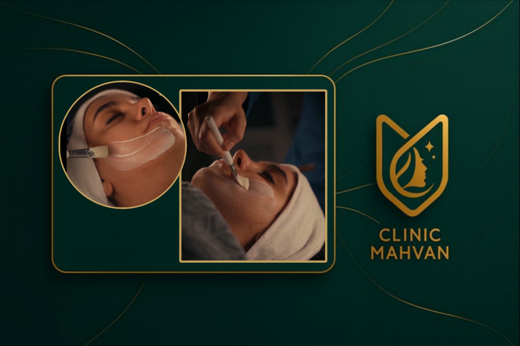 خدمات فیشال در کلینیک مهوان
