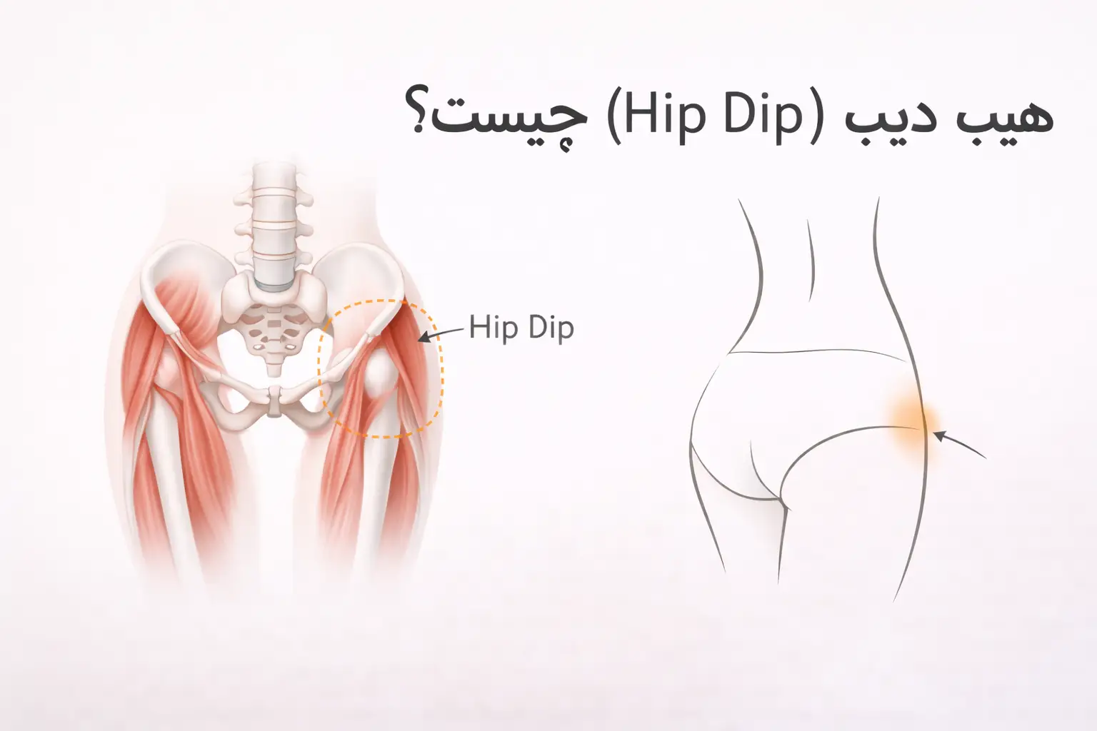 هیپ دیپ (Hip Dip) چیست