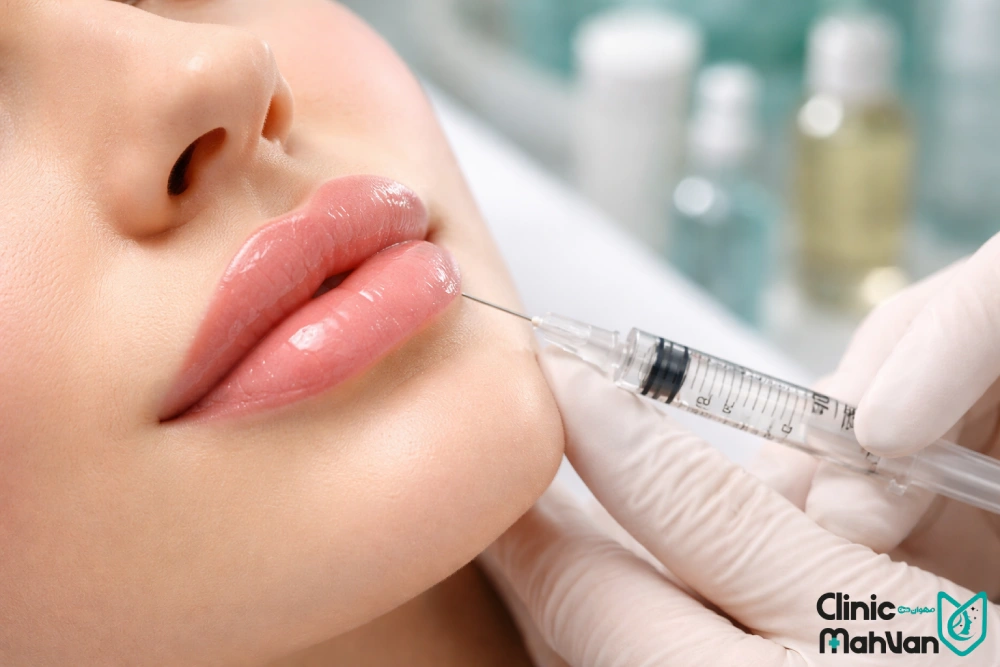 تزریق ژل لب در فردیس