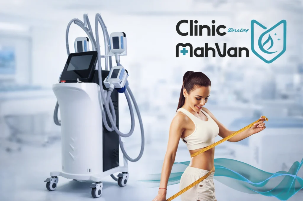لاغری با دستگاه کرایو در فردیس